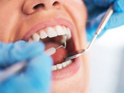 dental conditions